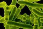 Bacilo de Koch, microorganismo causante de la tuberculosis