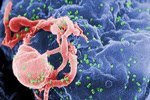 Virus de inmunodeficiencia humana (VIH), causante del SIDA