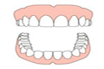 Dentadura superior e inferior