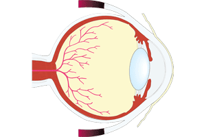 Localización de la retina en la parte posterior del ojo