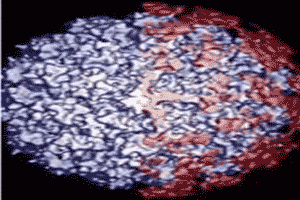 Imagen del virus del papiloma humano o VPH