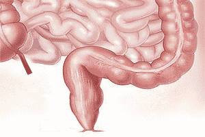 Vista del intestino grueso en la zona colorrectal