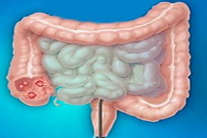 El intestino y sus diferentes partes